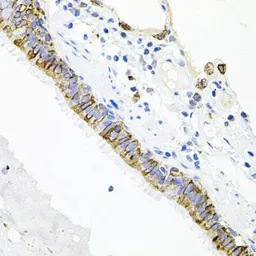Anti-Activin Receptor Type IIA antibody used in IHC (Paraffin sections) (IHC-P). GTX64724