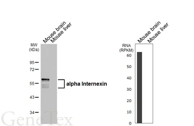 Anti-alpha Internexin antibody [HL5916] used in Western Blot (WB). GTX647241