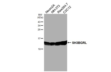 Anti-SH3BGRL antibody [HL5921] used in Western Blot (WB). GTX647246