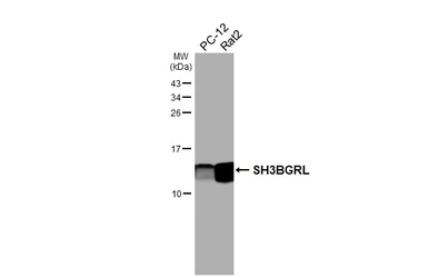 Anti-SH3BGRL antibody [HL5921] used in Western Blot (WB). GTX647246