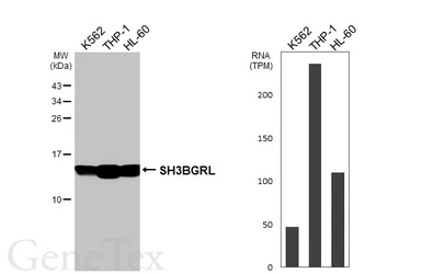 Anti-SH3BGRL antibody [HL5921] used in Western Blot (WB). GTX647246