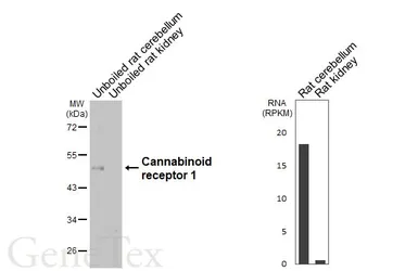 Anti-Cannabinoid receptor 1 antibody [HL5924] used in Western Blot (WB). GTX647249