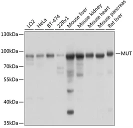 Anti-MUT antibody used in Western Blot (WB). GTX64725