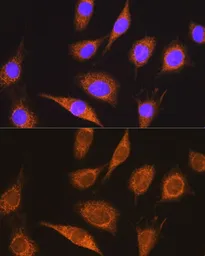 Anti-MUT antibody used in Immunocytochemistry/ Immunofluorescence (ICC/IF). GTX64725