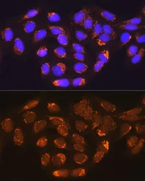 Anti-MUT antibody used in Immunocytochemistry/ Immunofluorescence (ICC/IF). GTX64725