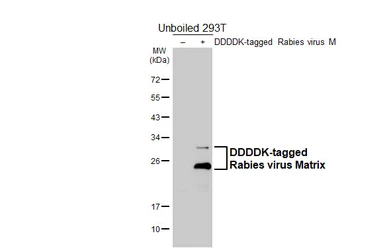 Anti-Rabies virus Matrix antibody [HL5925] (GTX647250) | GeneTex