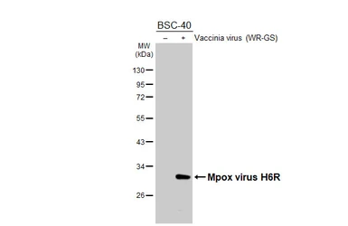Anti-Mpox virus H6R antibody [HL5928] used in Western Blot (WB). GTX647253