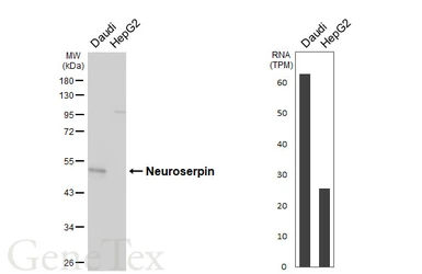 Anti-Neuroserpin antibody [HL5935] used in Western Blot (WB). GTX647260