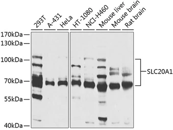 Anti-SLC20A1 antibody used in Western Blot (WB). GTX64727