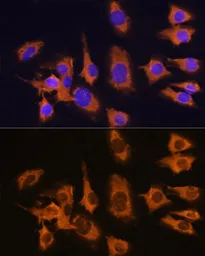 Anti-SLC20A1 antibody used in Immunocytochemistry/ Immunofluorescence (ICC/IF). GTX64727