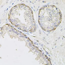Anti-CIB1 antibody used in IHC (Paraffin sections) (IHC-P). GTX64728
