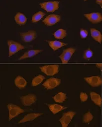 Anti-CSDE1 antibody used in Immunocytochemistry/ Immunofluorescence (ICC/IF). GTX64731