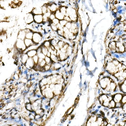 Anti-SHARP2 antibody used in IHC (Paraffin sections) (IHC-P). GTX64734