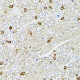 Anti-TPPP antibody used in IHC (Paraffin sections) (IHC-P). GTX64740
