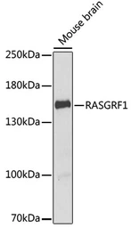 Anti-RASGRF1 antibody used in Western Blot (WB). GTX64744