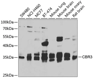 Anti-CBR3 antibody used in Western Blot (WB). GTX64745