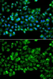 Anti-CBR3 antibody used in Immunocytochemistry/ Immunofluorescence (ICC/IF). GTX64745