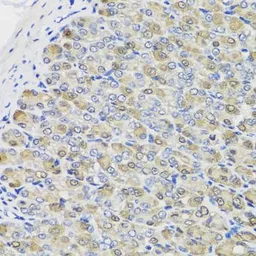 Anti-CBR3 antibody used in IHC (Paraffin sections) (IHC-P). GTX64745