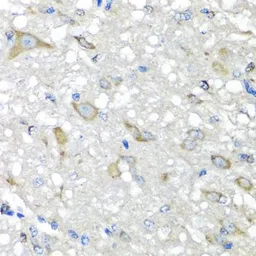Anti-CBR3 antibody used in IHC (Paraffin sections) (IHC-P). GTX64745