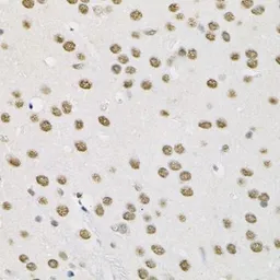 Anti-SMARCD1 antibody used in IHC (Paraffin sections) (IHC-P). GTX64747