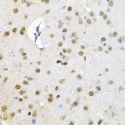 Anti-SMARCD1 antibody used in IHC (Paraffin sections) (IHC-P). GTX64747