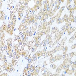 Anti-CHD1 antibody used in IHC (Paraffin sections) (IHC-P). GTX64749