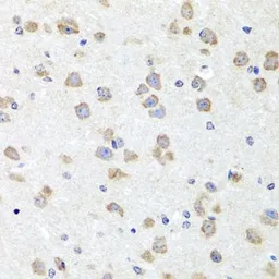 Anti-CHD1 antibody used in IHC (Paraffin sections) (IHC-P). GTX64749