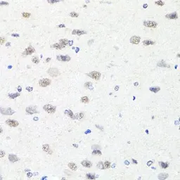 Anti-CHD1 antibody used in IHC (Paraffin sections) (IHC-P). GTX64749