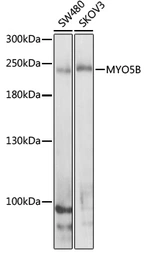 Anti-MYO5B antibody used in Western Blot (WB). GTX64751