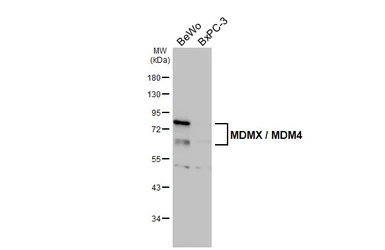Anti-MDMX / MDM4 antibody [HL5947] used in Western Blot (WB). GTX647559