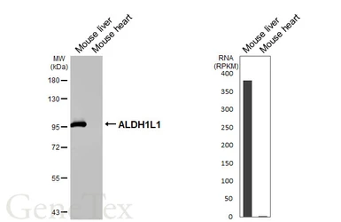 Anti-ALDH1L1 antibody [HL5956] used in Western Blot (WB). GTX647568