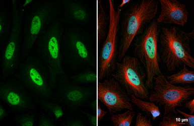 Anti-Anillin antibody [HL5957] used in Immunocytochemistry/ Immunofluorescence (ICC/IF). GTX647569