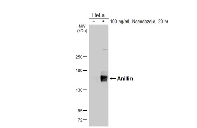 Anti-Anillin antibody [HL5957] used in Western Blot (WB). GTX647569