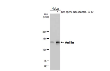 Anti-Anillin antibody [HL5958] used in Western Blot (WB). GTX647570