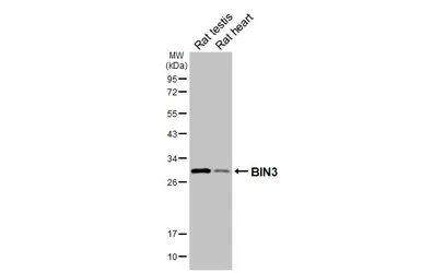 Anti-BIN3 antibody [HL5959] used in Western Blot (WB). GTX647571