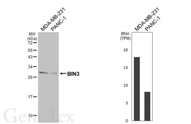 Anti-BIN3 antibody [HL5959] used in Western Blot (WB). GTX647571
