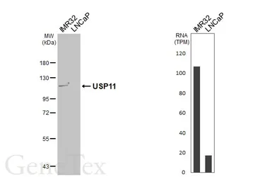 Anti-USP11 antibody [HL5963] used in Western Blot (WB). GTX647577
