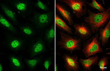 Anti-USP11 antibody [HL5963] used in Immunocytochemistry/ Immunofluorescence (ICC/IF). GTX647577