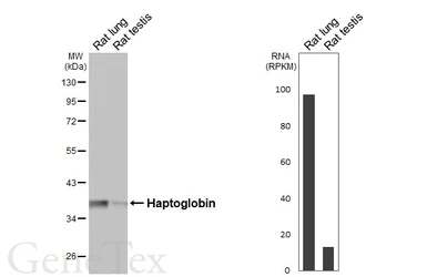 Anti-Haptoglobin antibody [HL5968] used in Western Blot (WB). GTX647582