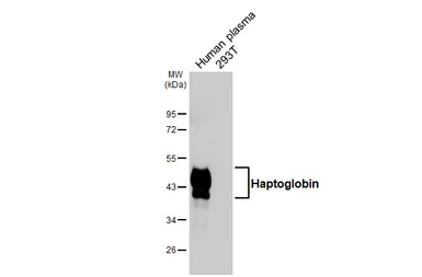 Anti-Haptoglobin antibody [HL5969] used in Western Blot (WB). GTX647583