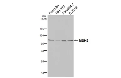 Anti-MSH2 antibody [HL5971] used in Western Blot (WB). GTX647585