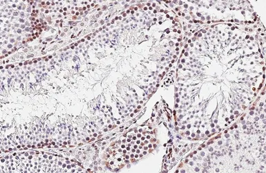 Anti-MSH2 antibody [HL5972] used in IHC (Paraffin sections) (IHC-P). GTX647586