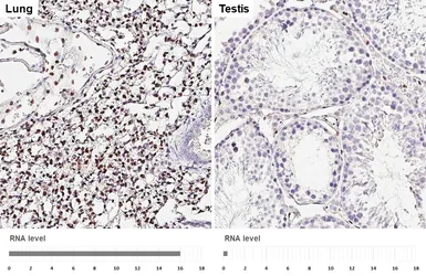 Anti-ERG antibody [HL5975] used in IHC (Paraffin sections) (IHC-P). GTX647589
