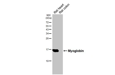 Anti-Myoglobin antibody [HL5977] used in Western Blot (WB). GTX647591