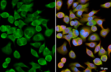 Anti-Myoglobin antibody [HL5980] used in Immunocytochemistry/ Immunofluorescence (ICC/IF). GTX647594