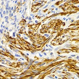 Anti-EDA antibody used in IHC (Paraffin sections) (IHC-P). GTX64760