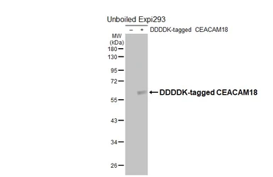 Anti-CEACAM18 Antibody [HL5988] used in Western Blot (WB). GTX647602