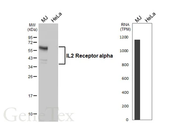 Anti-IL2 Receptor alpha antibody [HL5991] used in Western Blot (WB). GTX647605