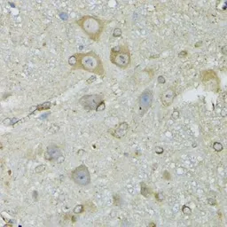 Anti-CRYM antibody used in IHC (Paraffin sections) (IHC-P). GTX64761
