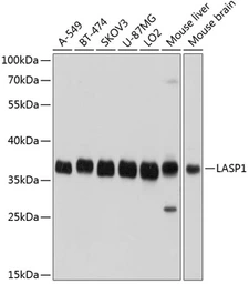 Anti-LASP1 antibody used in Western Blot (WB). GTX64762
